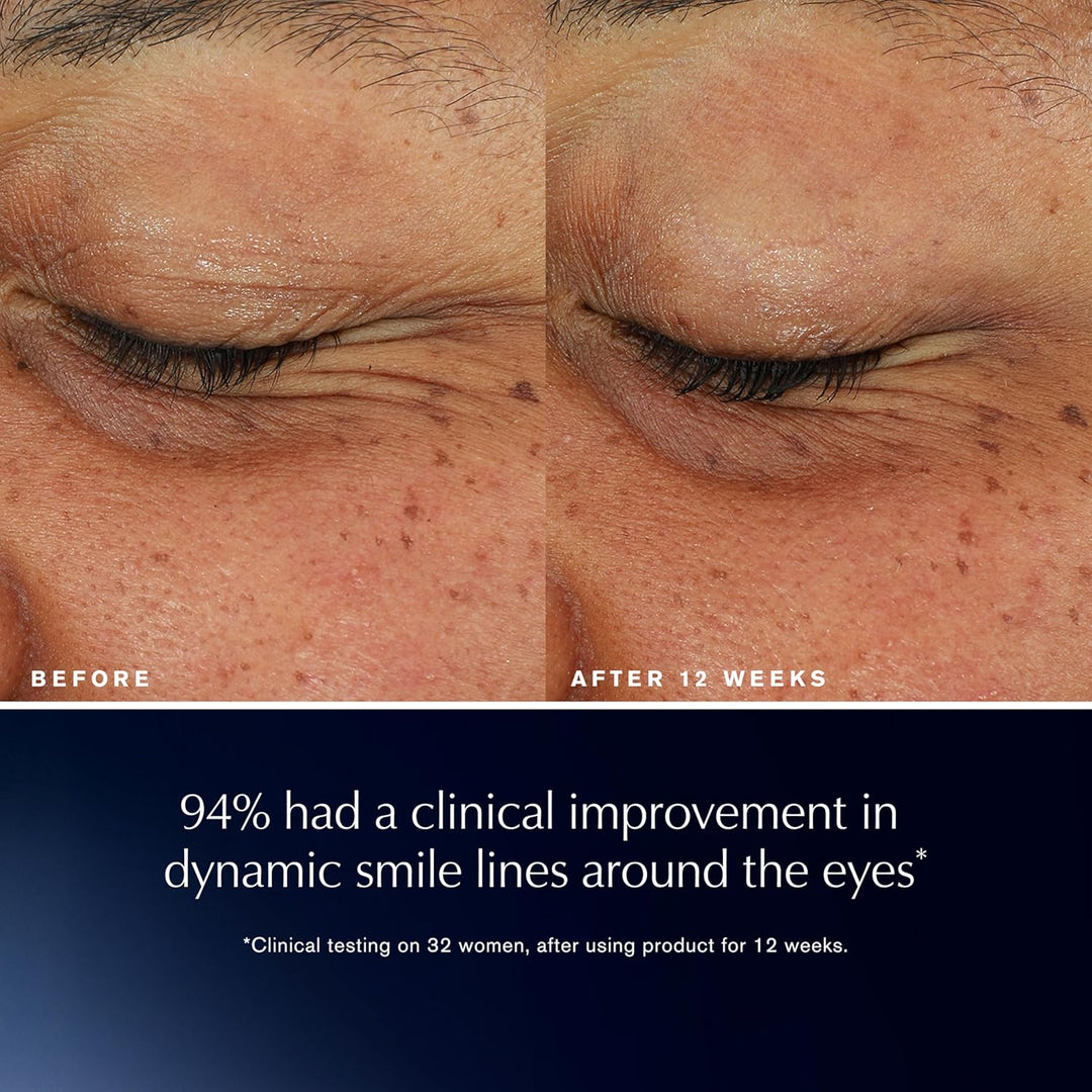 Advanced Night Repair Eye Lift + Sculpt Eye Cream