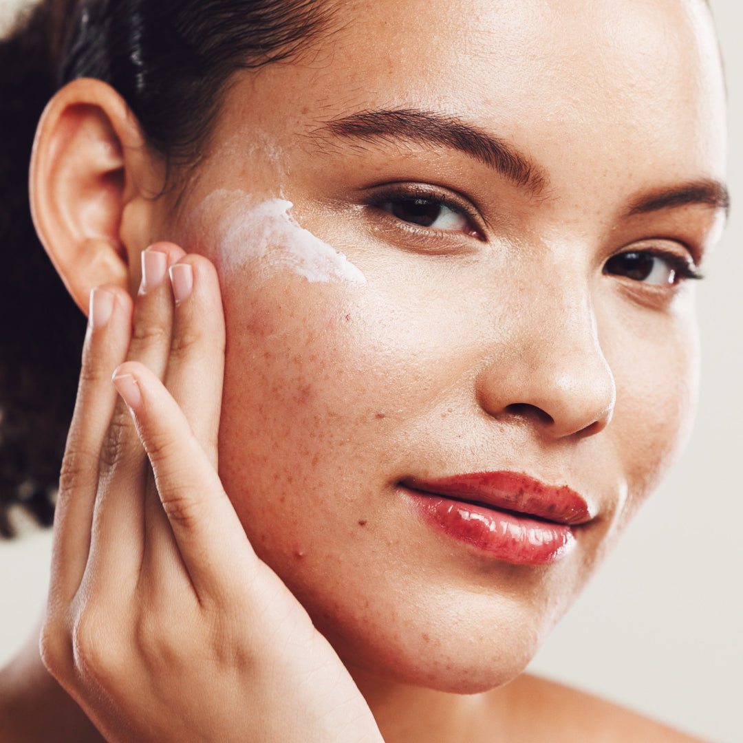 Acne Treatment | 3 Services