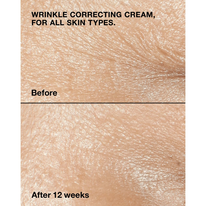 Wrinkle Fighting Routine