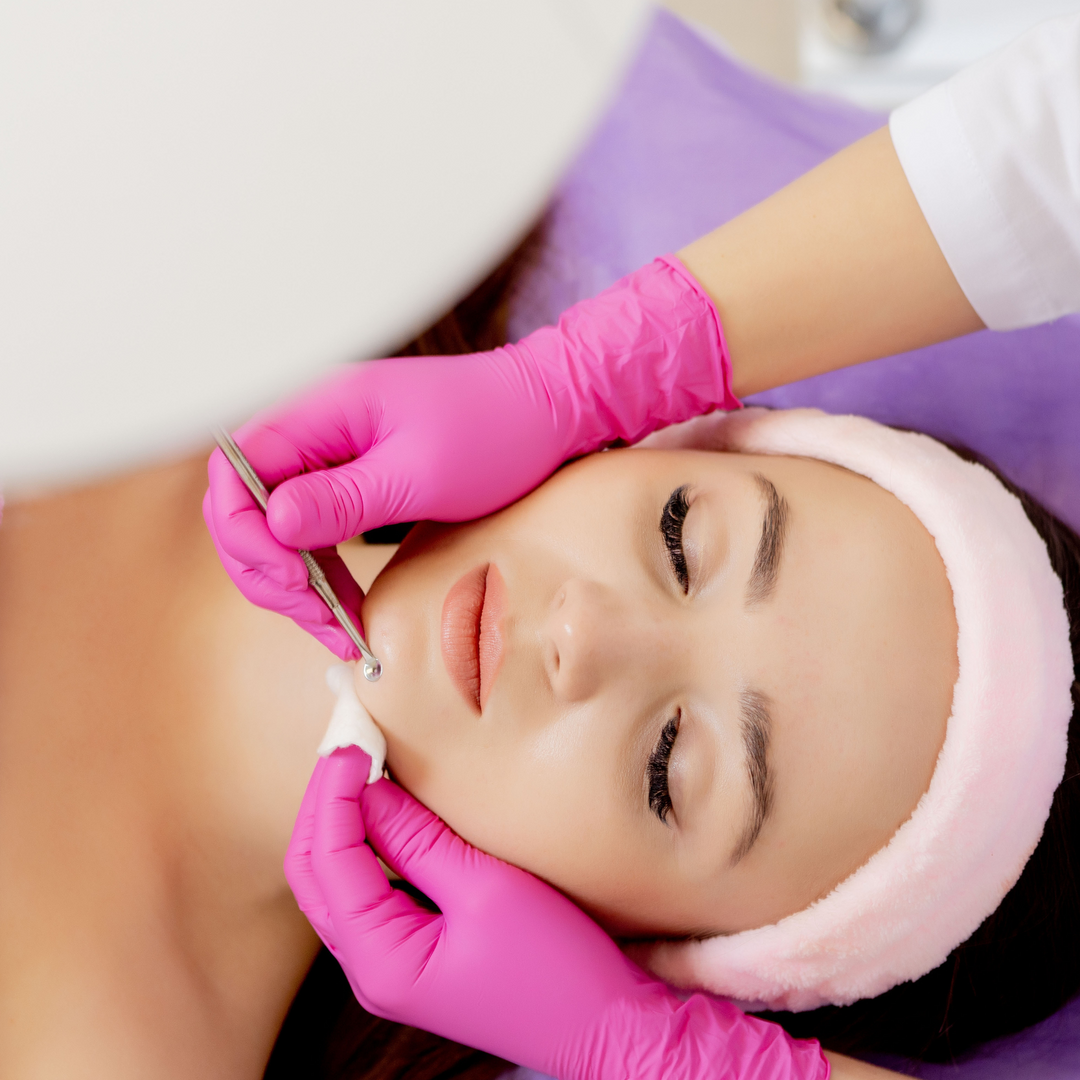 Acne Treatment | 3 Services